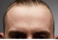  HD Face Skin John Hopkins eyebrow face forehead skin pores skin texture 0002.jpg